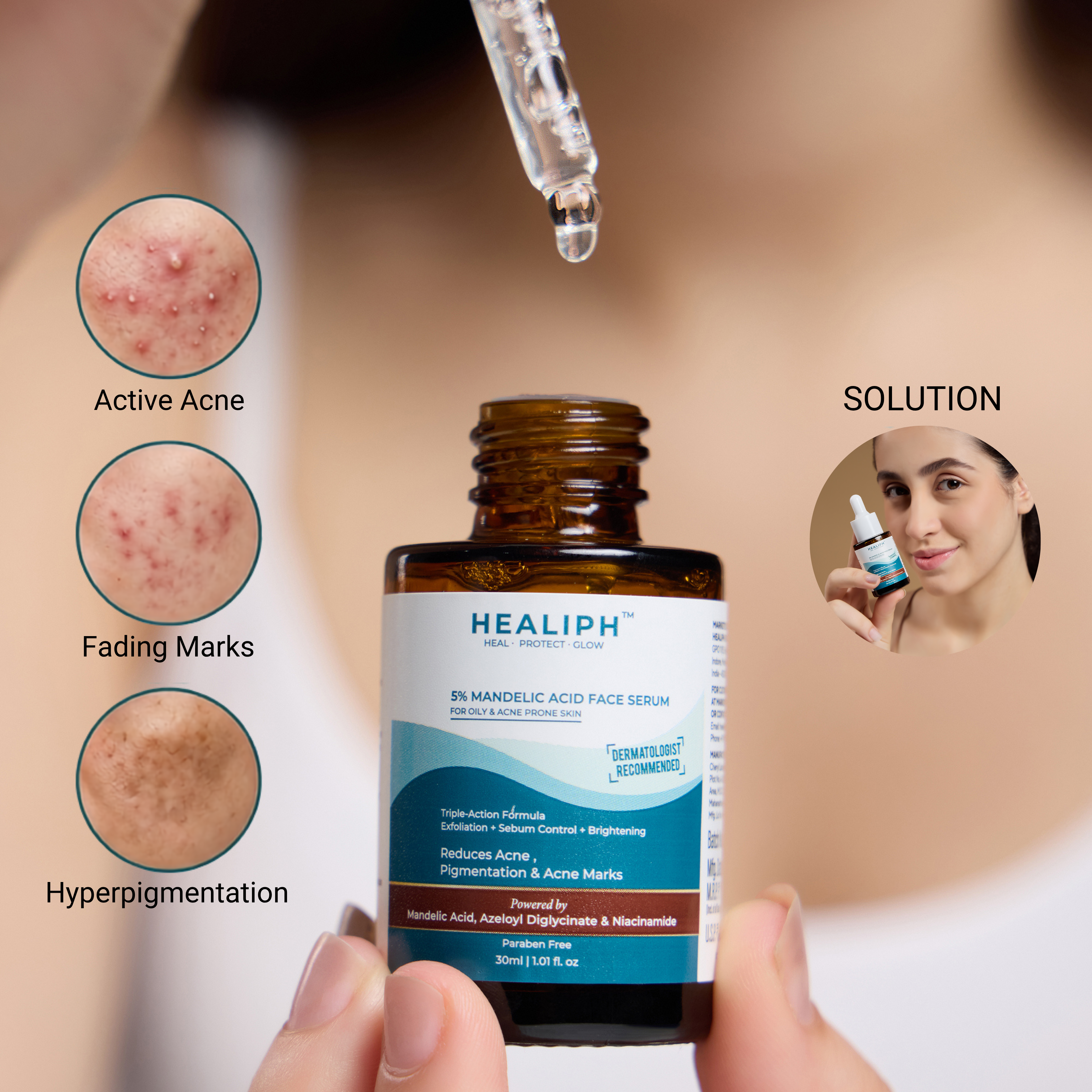 5% mandelic acid face serum- Reduces acne, pigmentation, acne marks